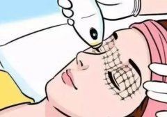 光子嫩膚4次后皮膚越來(lái)越差？并不是所有的人都適合于光子嫩膚這個(gè)項(xiàng)目